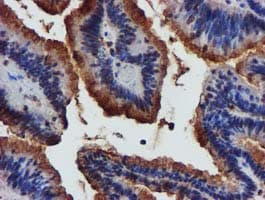 Complement C1s Antibody (clone OTI4E3)