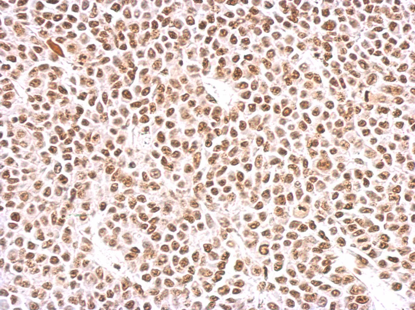 Polyclonal Rabbit anti-Human PAX8 Antibody (aa1-204, IHC, WB)