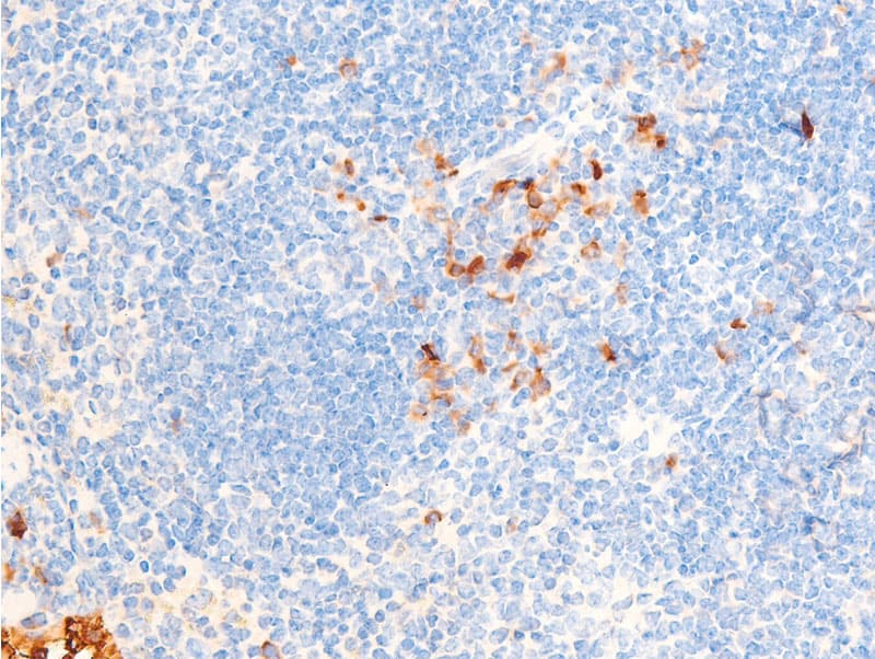 CHEK1 / CHK1 Antibody (phospho-Ser286)