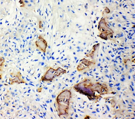 IBSP / Bone Sialoprotein Antibody (aa17-34)