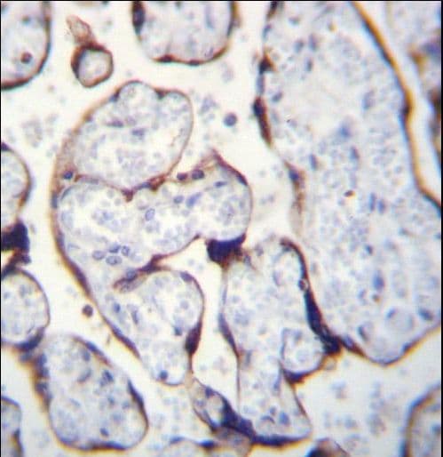 Polyclonal Rabbit anti-Human LETM2 Antibody (aa101-129, IHC, WB)