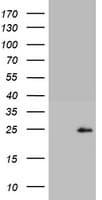 Monoclonal Mouse anti-Human CD8A / CD8 Alpha Antibody (clone OTI7C10, aa22-182, IHC, WB)