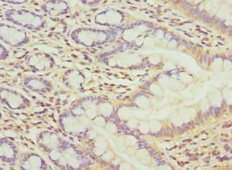 MBTPS1 / S1P Antibody