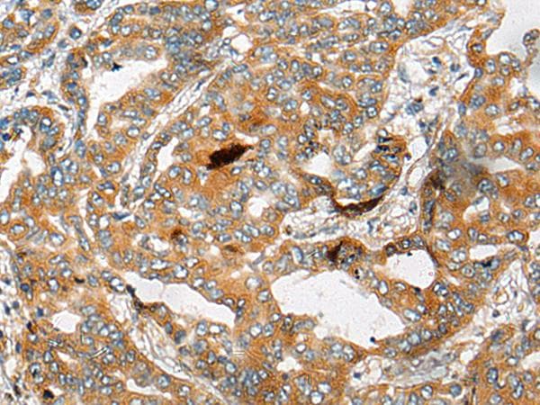 CHCHD3 Antibody