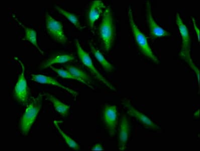 Polyclonal Rabbit anti-Human PCMT1 Antibody (IHC)
