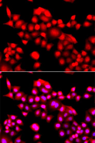 TEAD3 Antibody