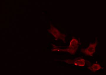 MIA2 Antibody