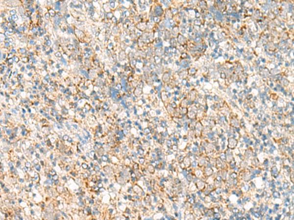 Polyclonal Rabbit anti-Human PSD4 Antibody (IHC)