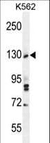 TTBK2 Antibody (aa217-245)