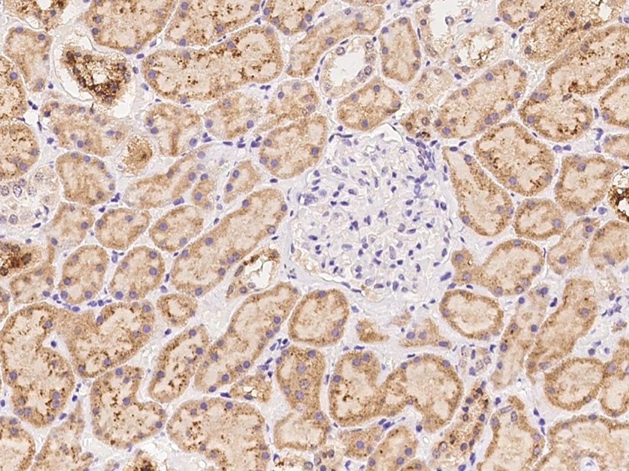 Polyclonal Rabbit anti-Human SPP1 / Osteopontin Antibody (IHC)