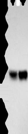 ZFYVE19 Antibody