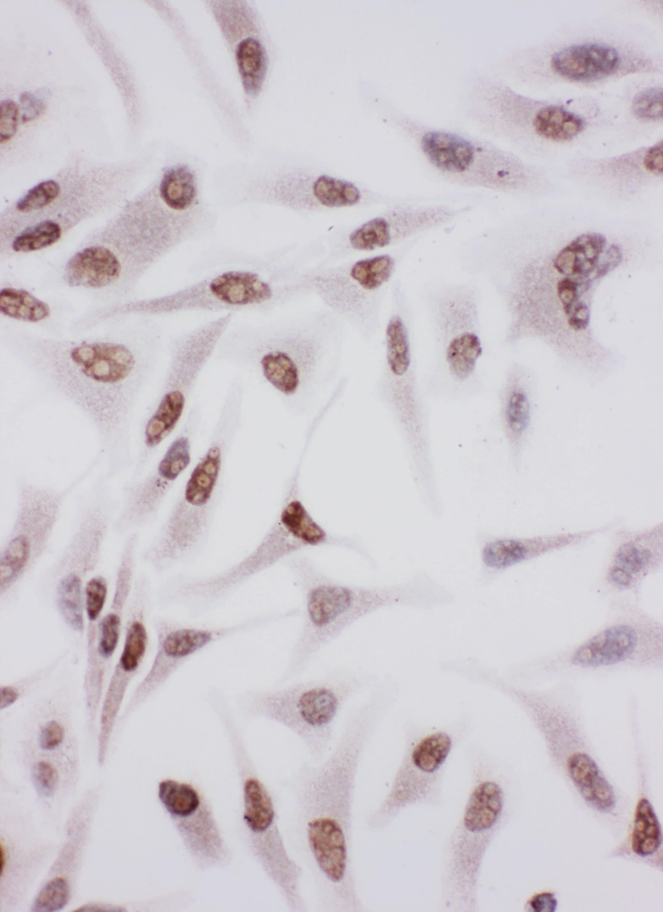XRCC6 / Ku70 Antibody (aa530-545)
