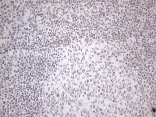 NR2C2 / TAK1 Antibody (aa1-241, clone OTI2H2)
