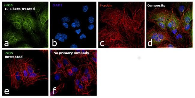 NOS2 / iNOS Antibody (clone 400000)