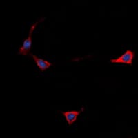 Polyclonal Rabbit anti-Human GPCR6 / GPR101 Antibody (Internal, IF, WB)