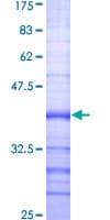 Human BMP2K / BIKE Protein (Recombinant GST, N-terminus)