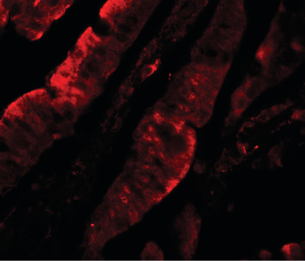 IHC-plus™ Polyclonal Rabbit anti-Human TFPI / LACI Antibody (IHC, IF, WB)