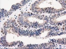 CAT / Catalase Antibody (clone OTI1B8)
