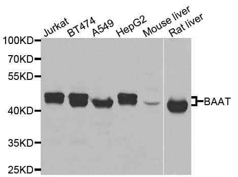 Polyclonal Rabbit anti-Human BAAT / BAT Antibody (IHC, WB)