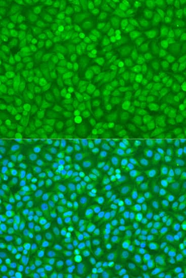FOXO3 / FOXO3A Antibody