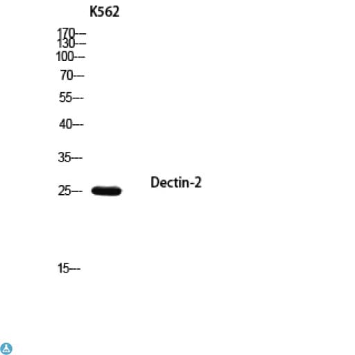 CLEC6A / Dectin 2 Antibody