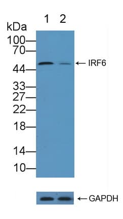Polyclonal Rabbit anti-Human IRF6 Antibody (aa196-445, WB)