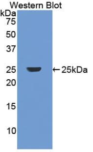 GC / Vitamin D-Binding Protein Antibody (aa209-401)