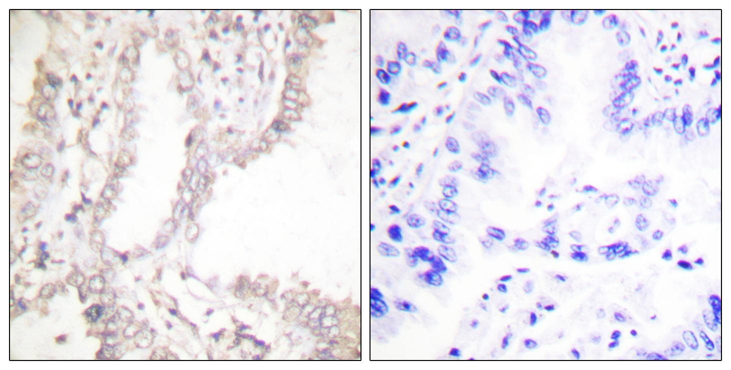 PAWR / PAR4 Antibody