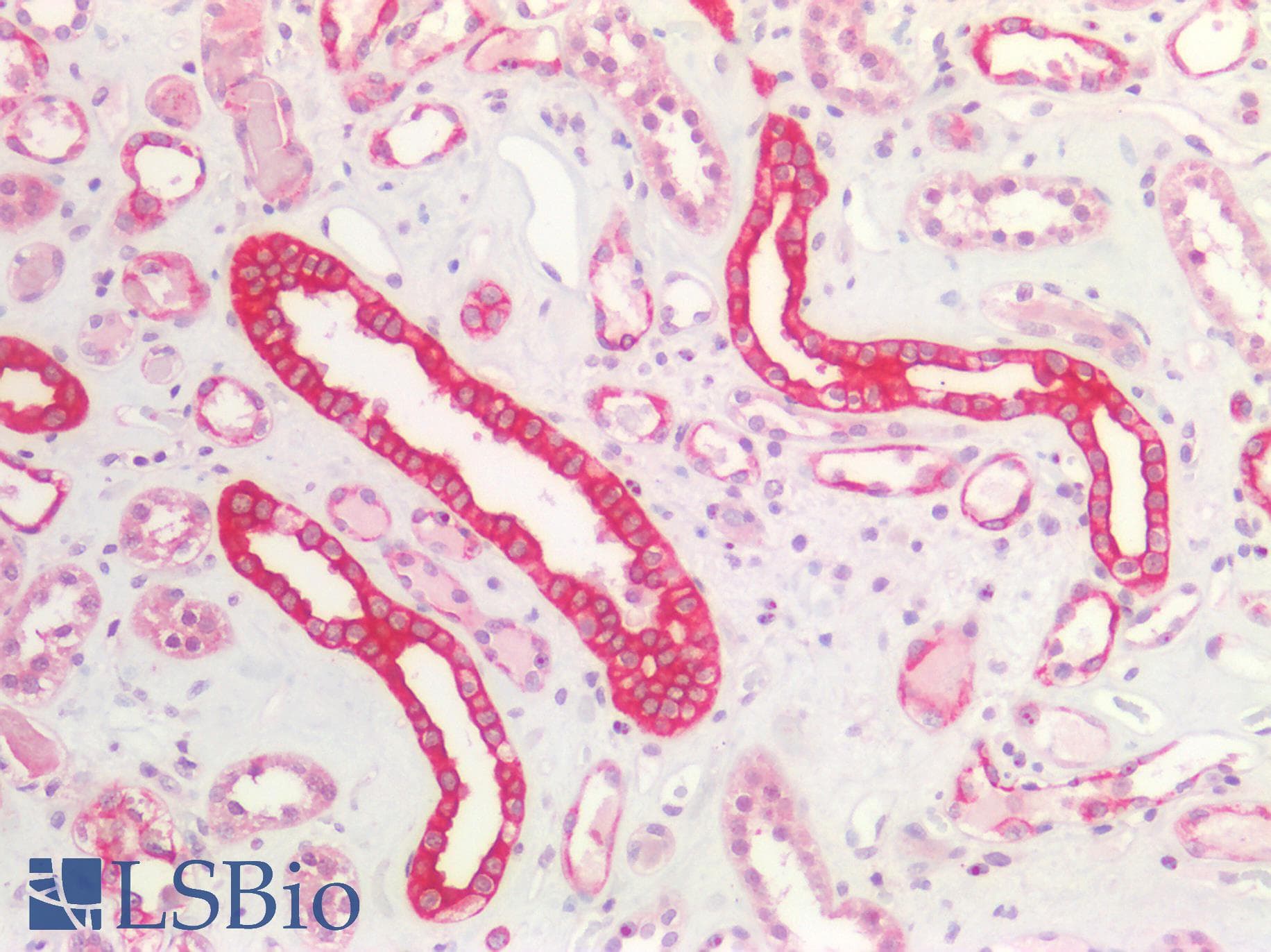 PathPlus™ Polyclonal Rabbit anti-Human INHBA / Inhibin Beta A Antibody (aa35-84, IHC, WB)