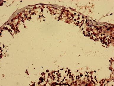FOXP1 Antibody