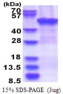 Human ZCCHC12 Protein (Recombinant His)