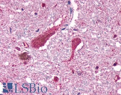 PathPlus™ Polyclonal Rabbit anti-Human CNR1 / CB1 Antibody (C-Terminus, IHC)