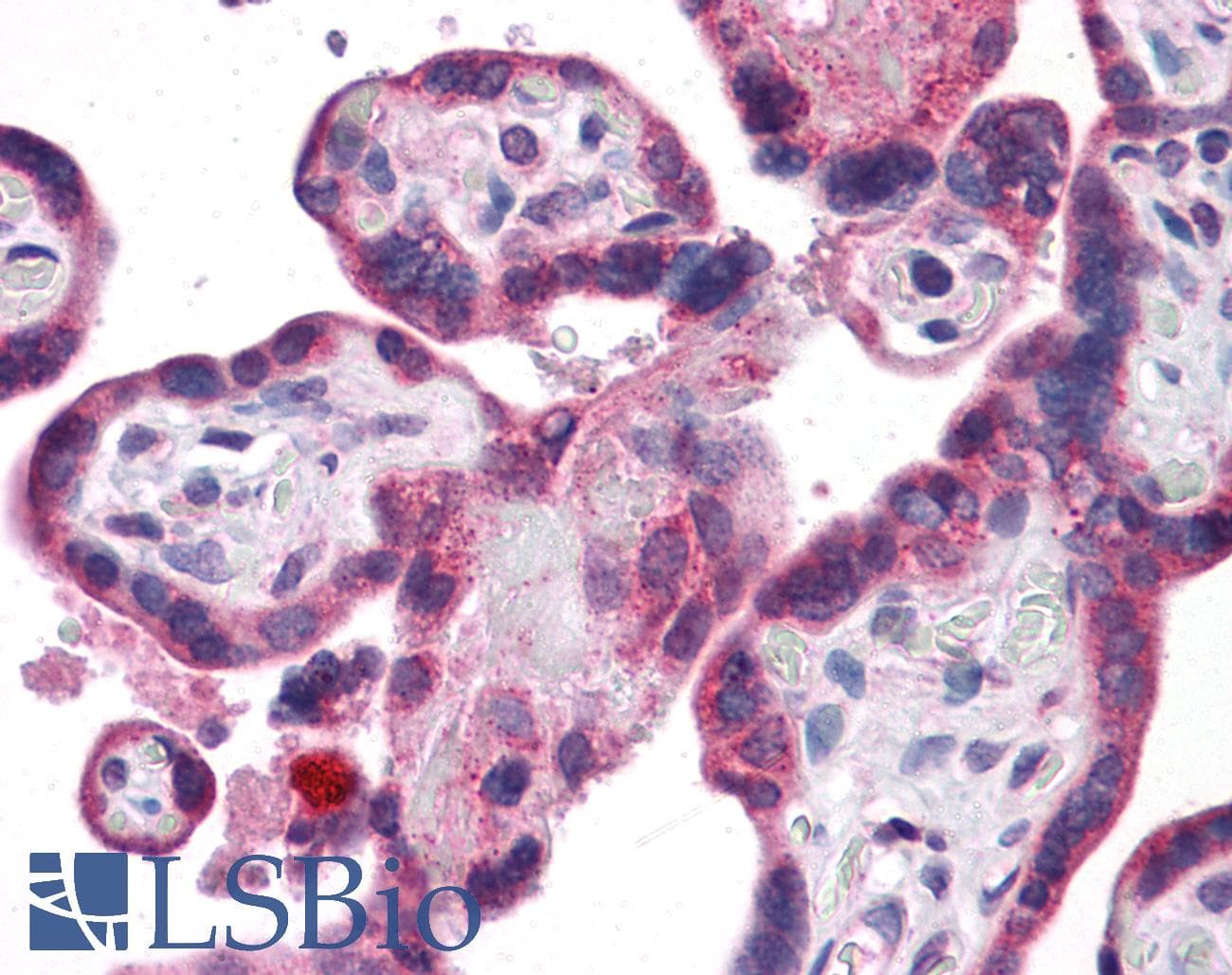 IHC-plus™ Polyclonal Rabbit anti-Human GPR32 Antibody (IHC, WB)