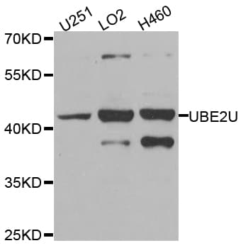 Polyclonal Rabbit anti-Human UBE2U Antibody (IHC, WB)