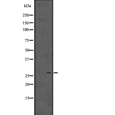 Polyclonal Rabbit anti-Human ENKUR Antibody (IF, WB)
