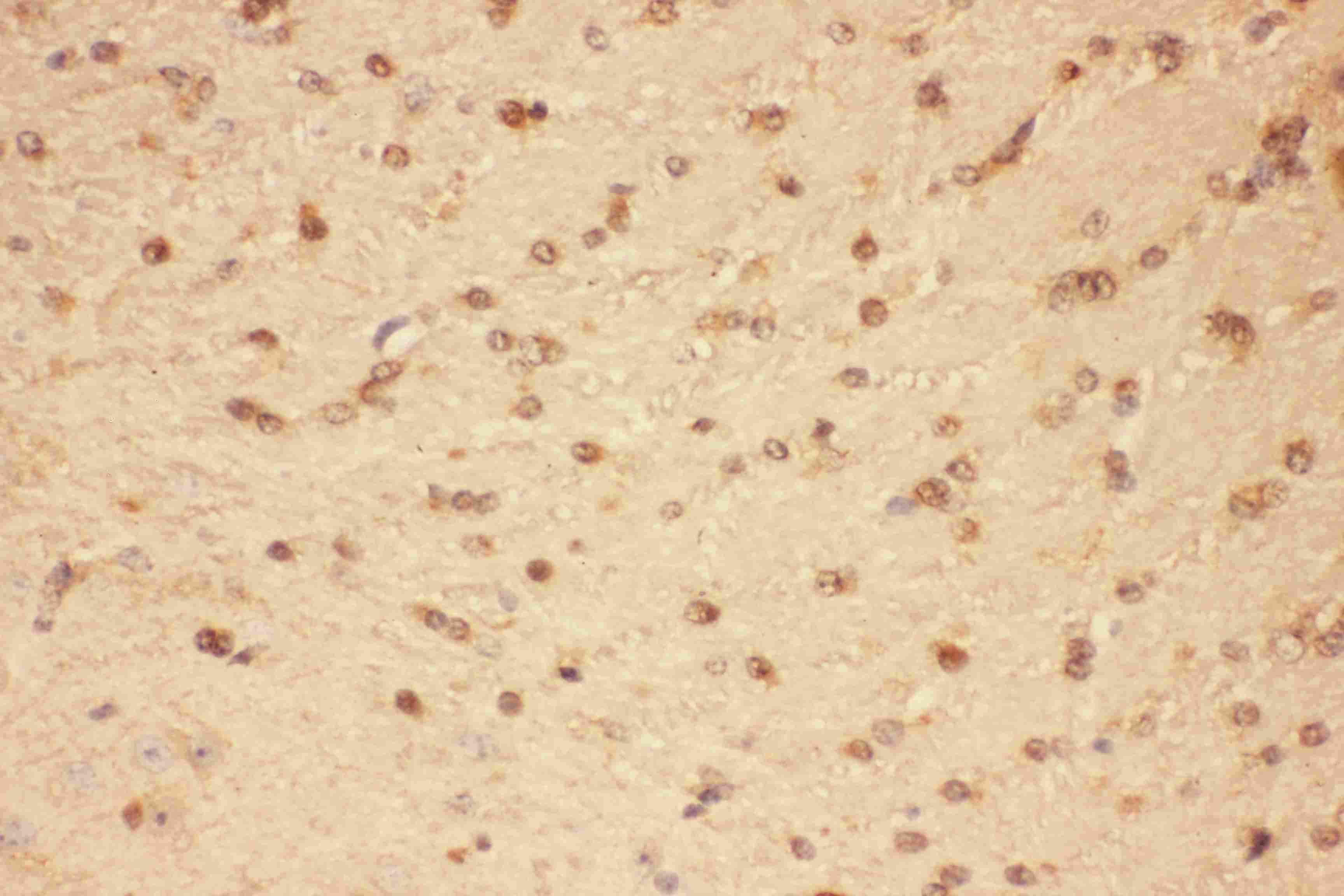 CNTF Antibody (aa2-198)
