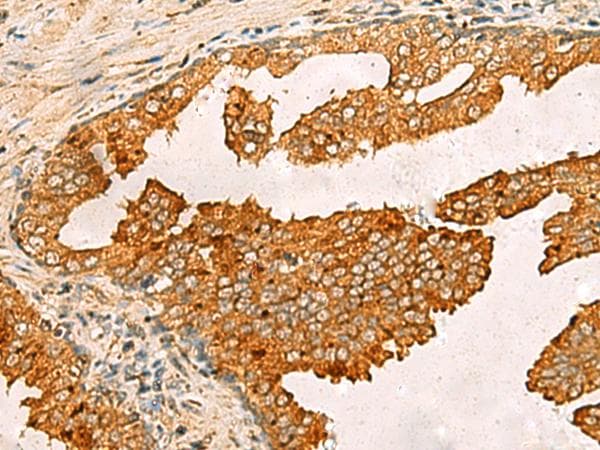 BECN1 / Beclin-1 Antibody