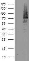 Monoclonal Mouse anti-Human BIRC3 / cIAP2 Antibody (clone OTI3G4, aa255-529, WB)