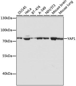 YAP / YAP1 Antibody