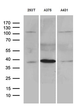 Monoclonal Mouse anti-Human HOXD8 Antibody (clone OTI1E3, aa69-290, WB)