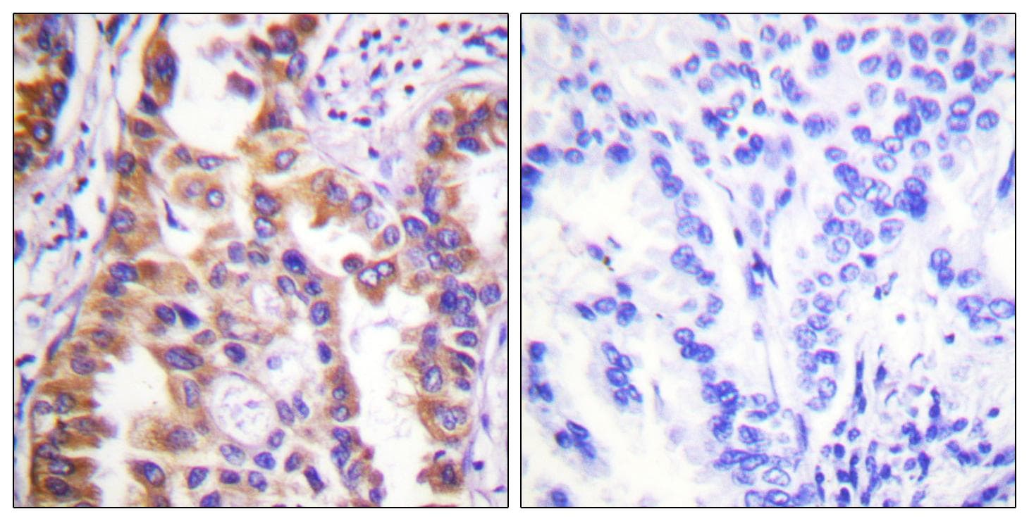 Polyclonal Rabbit anti-Human Tuberin / TSC2 Antibody (p939, IHC, IF, WB)