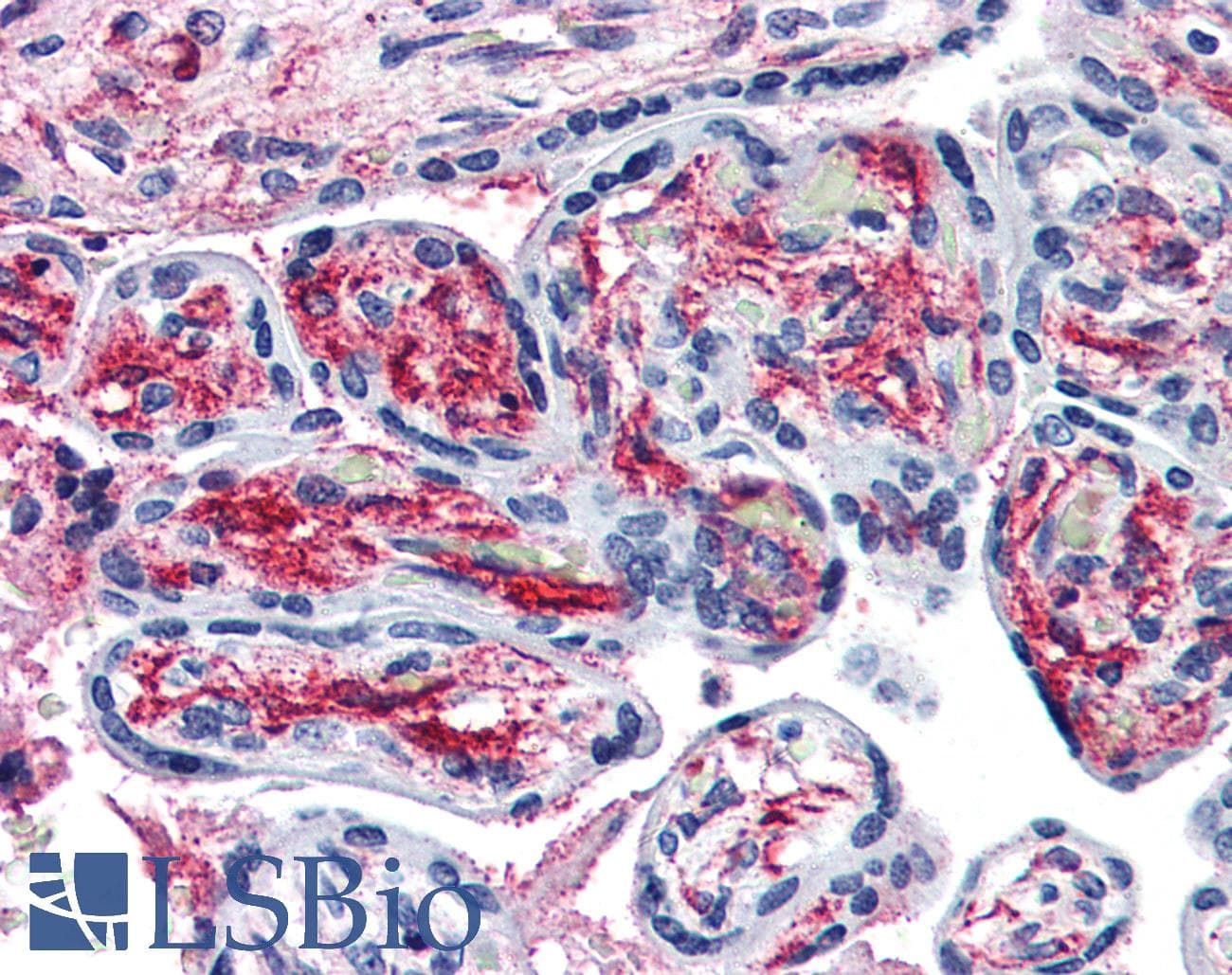 IHC-plus™ PACE4 / PCSK6 Antibody (Internal)