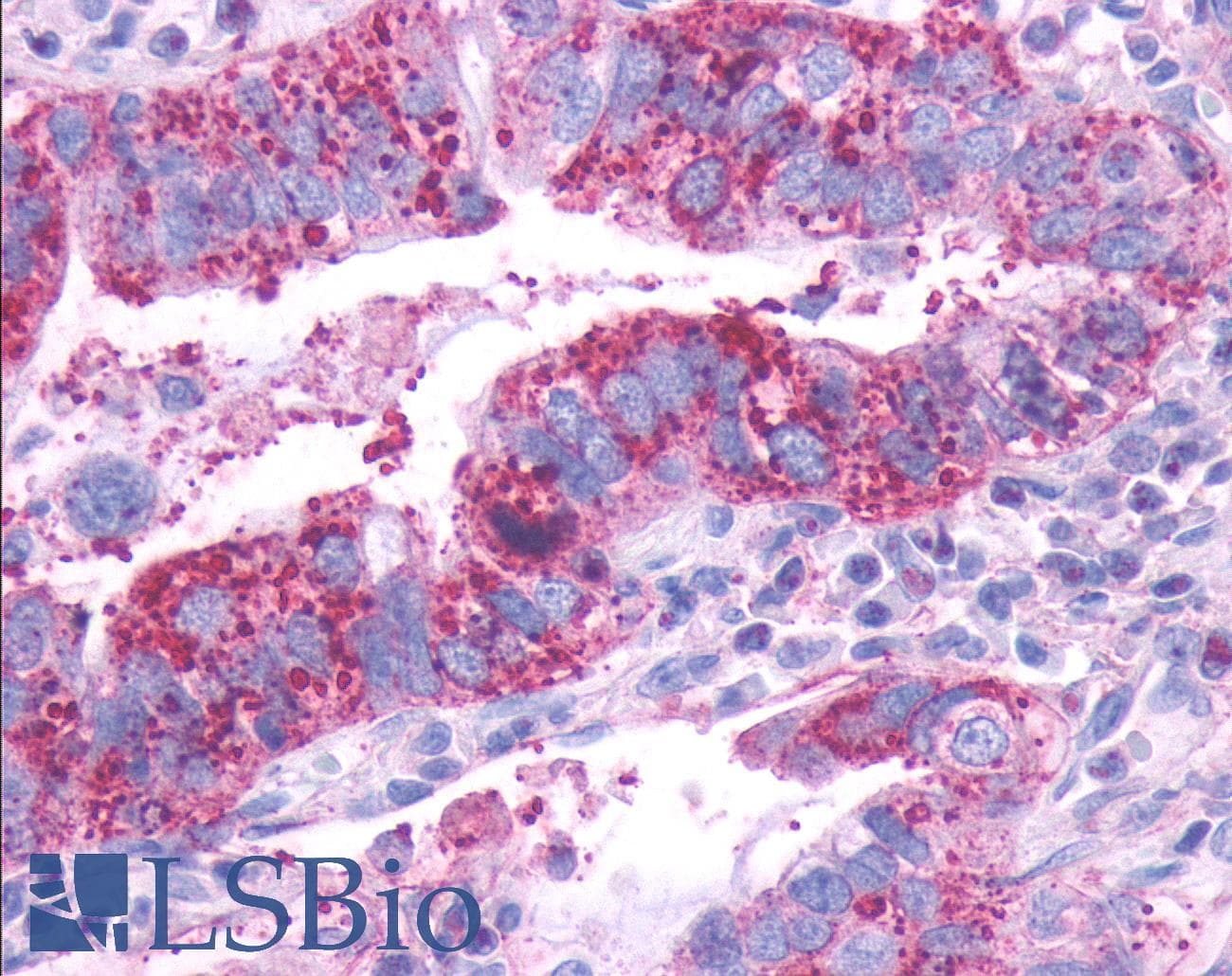 PathPlus™ DRD1 / Dopamine Receptor D1 Antibody (C-Terminus)