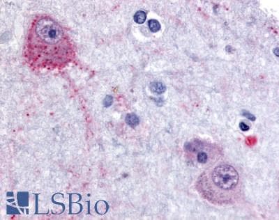 IHC-plus™ Polyclonal Rabbit anti-Human PACE4 / PCSK6 Antibody (Internal, IHC)