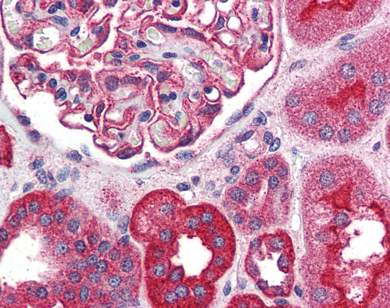 IHC-plus™ TRPM4 Antibody (N-Terminus)