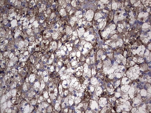 Monoclonal Mouse anti-Human TG / Thyroglobulin Antibody (clone OTI8F6, aa20-358, IHC, WB)
