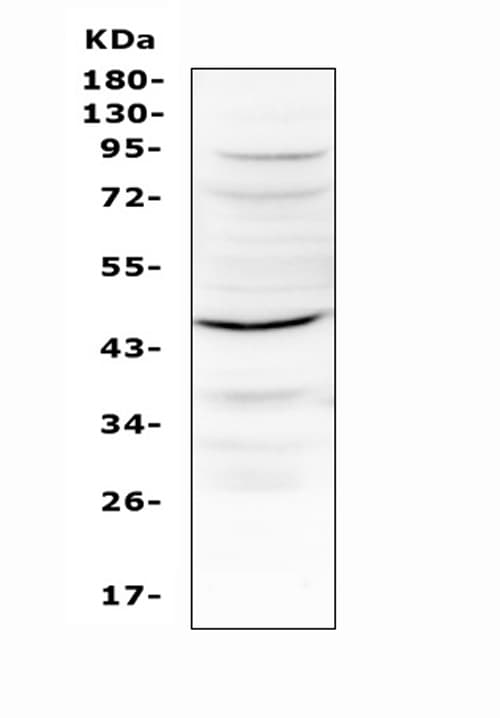 IL12B / IL12 p40 Antibody