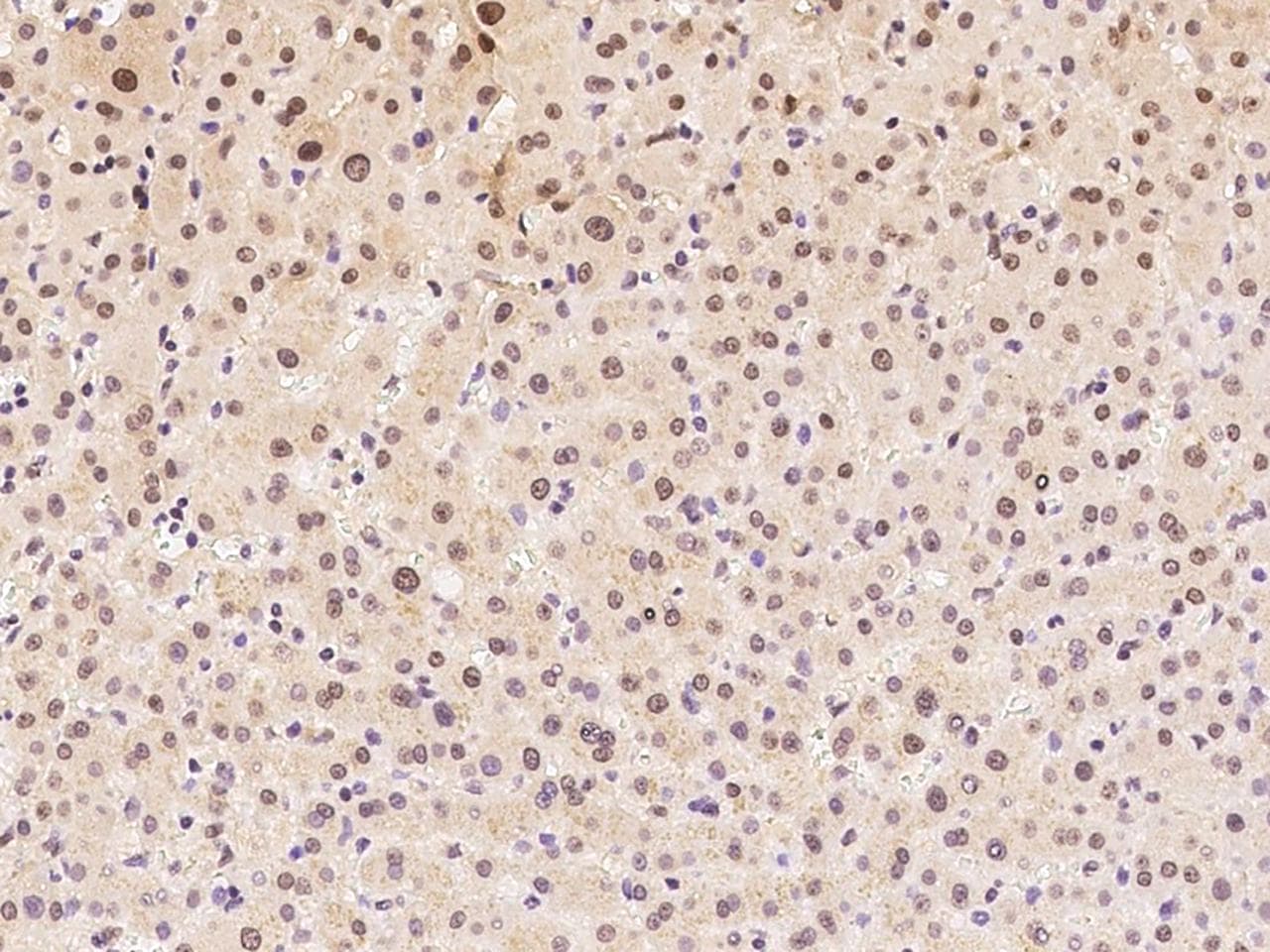 Aprataxin / APTX Antibody