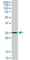 APG5 / ATG5 Antibody (clone 4B7)