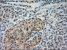 Monoclonal Mouse anti-Human IRF3 Antibody (clone OTI4D4, IHC, IF, WB)